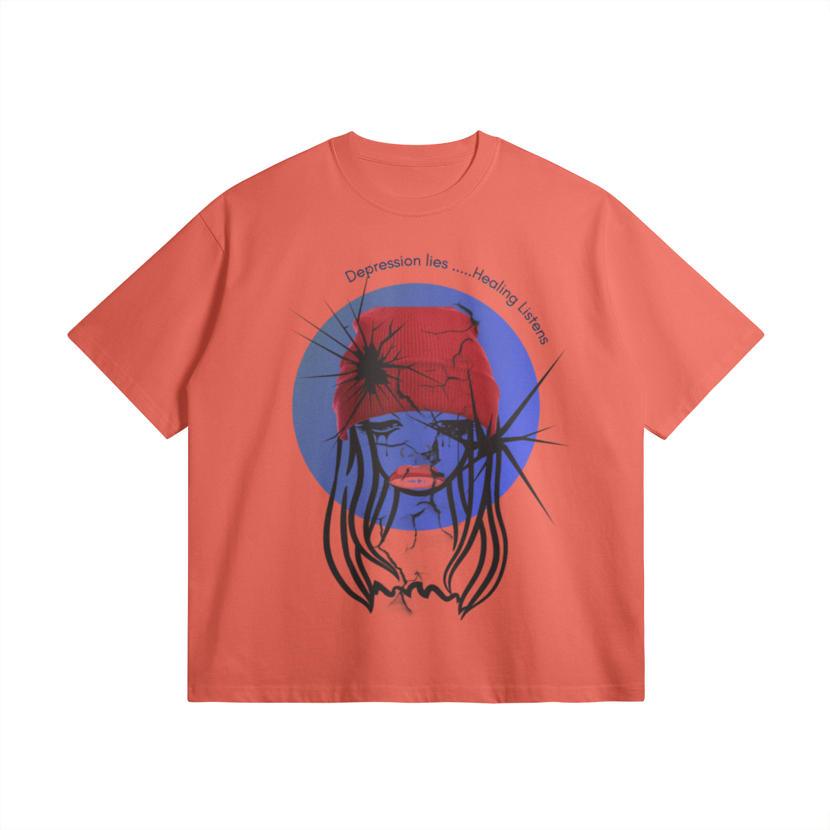 0-YD2-Front Side
